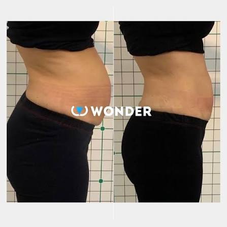 wonder axon at Aesthetics Africa