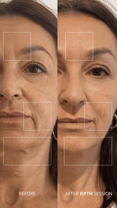 Wonder Face at Aesthetics Africa